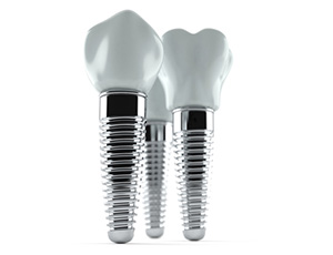 three dental implant posts with crowns