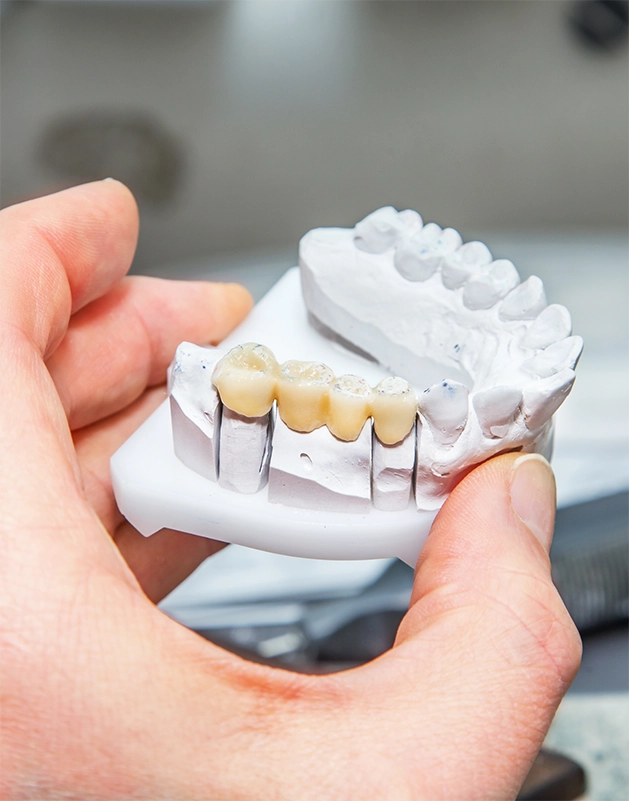 Hand holding a model of a dental bridge