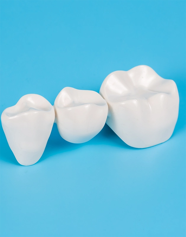 Model of a dental bridge