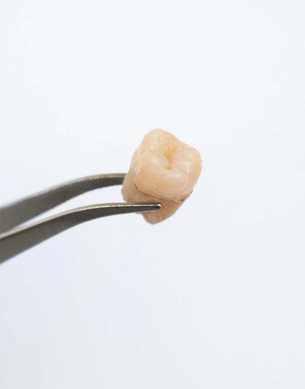 Tweezers holding an extracted tooth