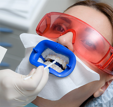 Dental patient getting professional teeth whitening