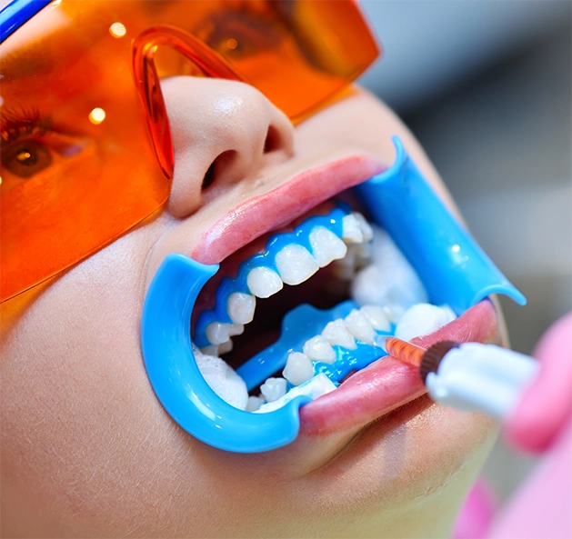 Dental patient having their teeth whitened